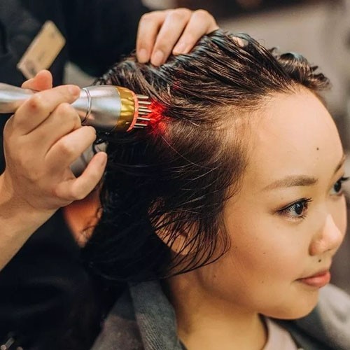 Scalp Treatment